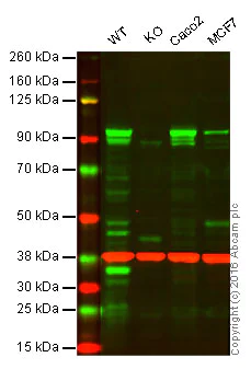 Western blot - Anti-SUZ12 antibody [EPR5234(N)] - ChIP Grade (AB175187)