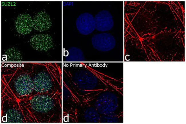 Immunocytochemistry/ Immunofluorescence - Anti-SUZ12 Antibody [RP23040202] (AB313424)