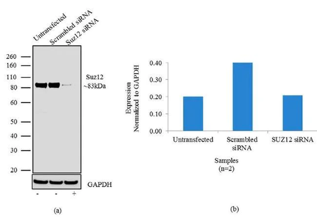 Western blot - Anti-SUZ12 Antibody [RP23040202] (AB313424)