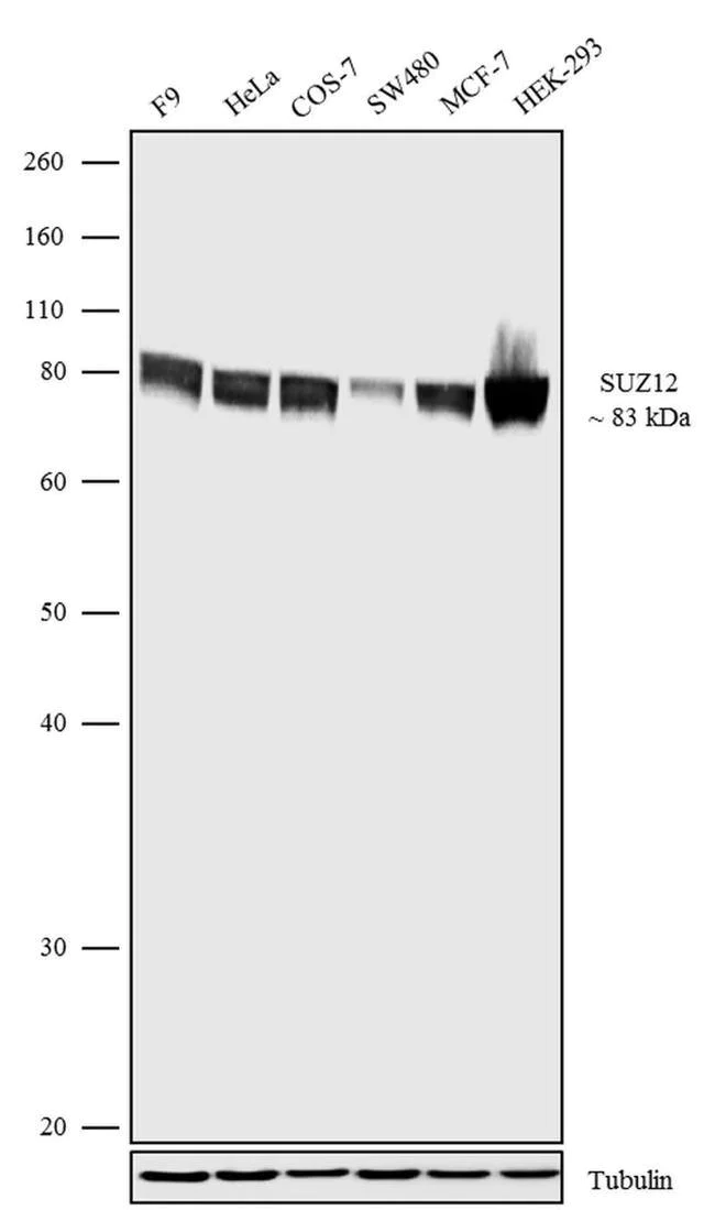 Western blot - Anti-SUZ12 Antibody [RP23040202] (AB313424)