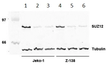 Western blot - Anti-SUZ12 antibody [SUZ220A] (AB126577)
