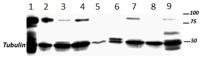 Western blot - Anti-SUZ12 antibody [SUZ220A] (AB126577)