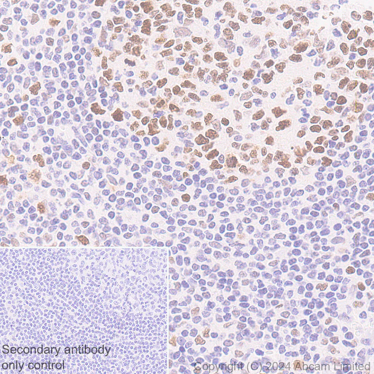 Immunohistochemistry (Formalin/PFA-fixed paraffin-embedded sections) - Anti-SUZ12 antibody [SUZ220A] - BSA and Azide free (AB324760)
