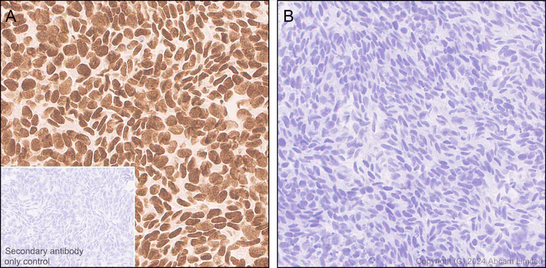 Immunohistochemistry (Formalin/PFA-fixed paraffin-embedded sections) - Anti-SUZ12 antibody [SUZ220A] - BSA and Azide free (AB324760)