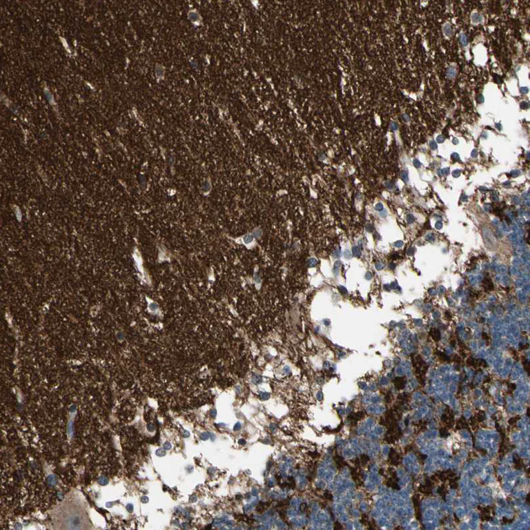 Immunohistochemistry (Formalin/PFA-fixed paraffin-embedded sections) - Anti-SV2A antibody (AB224073)