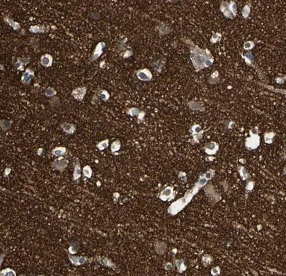Immunohistochemistry (Formalin/PFA-fixed paraffin-embedded sections) - Anti-SV2A antibody (AB224073)