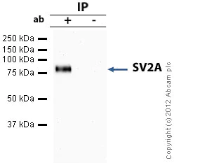 Immunoprecipitation - Anti-SV2A antibody (AB32942)
