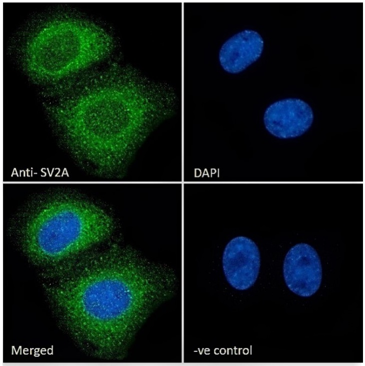 Immunocytochemistry - Anti-SV2A antibody (AB77177)