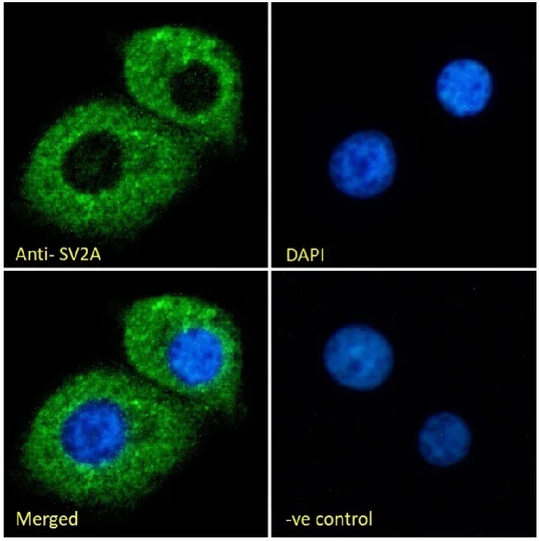 Immunocytochemistry - Anti-SV2A antibody (AB77177)