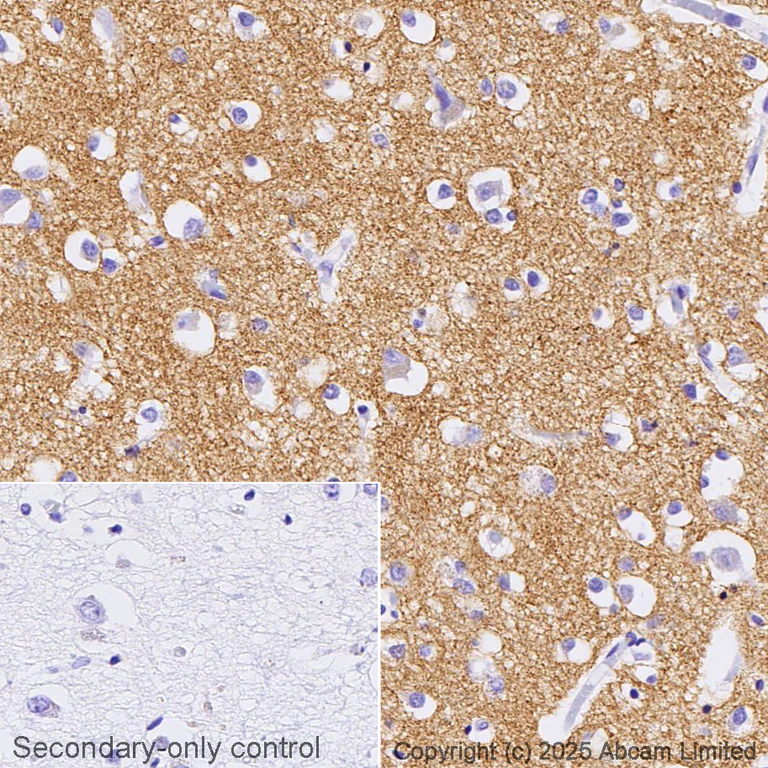Immunohistochemistry (Formalin/PFA-fixed paraffin-embedded sections) - Anti-SV2A antibody [EPR23500-32] - BSA and Azide free (AB273513)