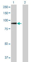 Western blot - Anti-SV2B antibody (AB68025)
