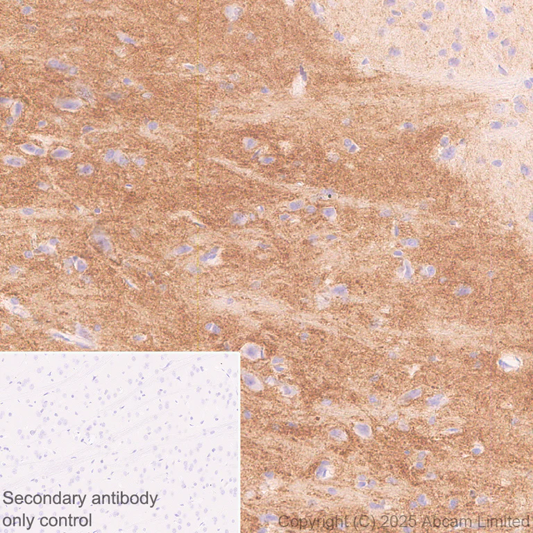Immunohistochemistry (Formalin/PFA-fixed paraffin-embedded sections) - Anti-SV2C antibody [EPR30548-547] (AB324233)