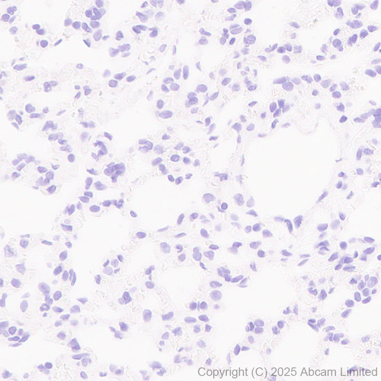 Immunohistochemistry (Formalin/PFA-fixed paraffin-embedded sections) - Anti-SV2C antibody [EPR30548-547] (AB324233)