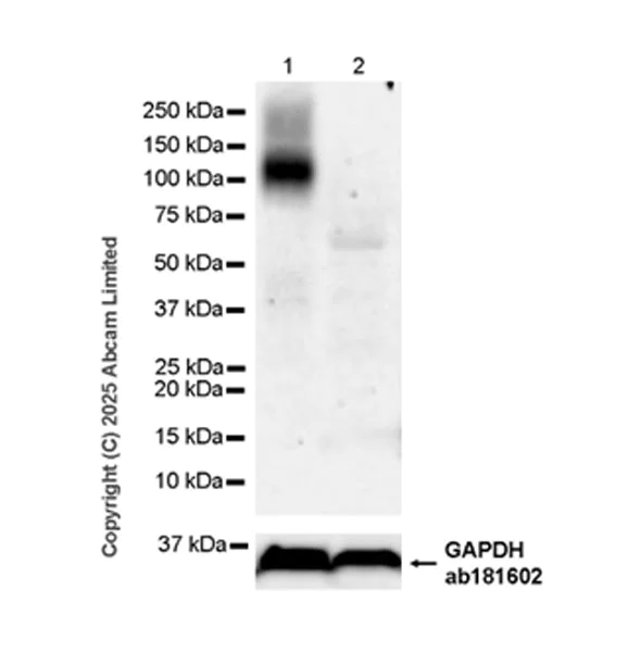 Western blot - Anti-SV2C antibody [EPR30548-547] (AB324233)