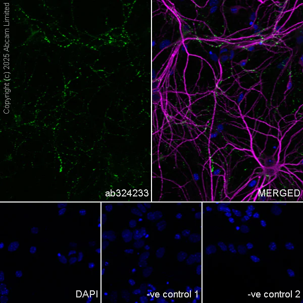 Immunocytochemistry/ Immunofluorescence - Anti-SV2C antibody [EPR30548-547] - BSA and Azide free (AB324234)