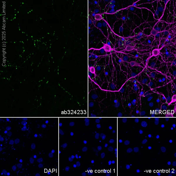 Immunocytochemistry/ Immunofluorescence - Anti-SV2C antibody [EPR30548-547] - BSA and Azide free (AB324234)