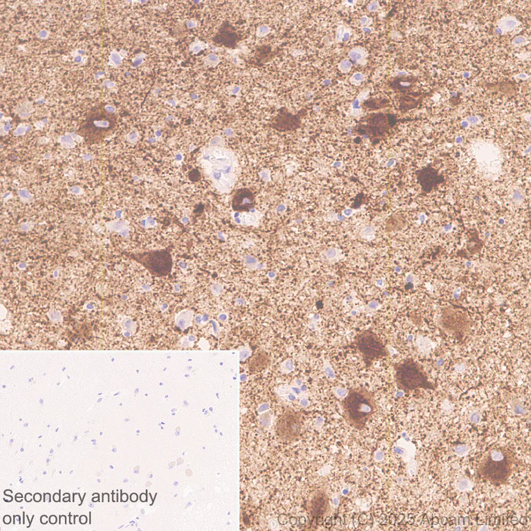Immunohistochemistry (Formalin/PFA-fixed paraffin-embedded sections) - Anti-SV2C antibody [EPR30548-547] - BSA and Azide free (AB324234)