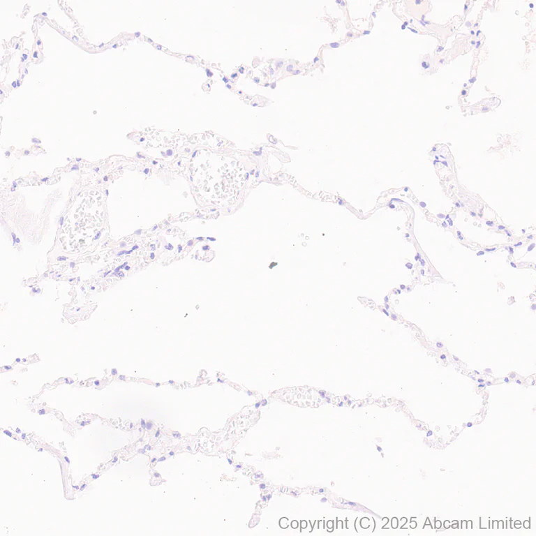 Immunohistochemistry (Formalin/PFA-fixed paraffin-embedded sections) - Anti-SV2C antibody [EPR30548-547] - BSA and Azide free (AB324234)