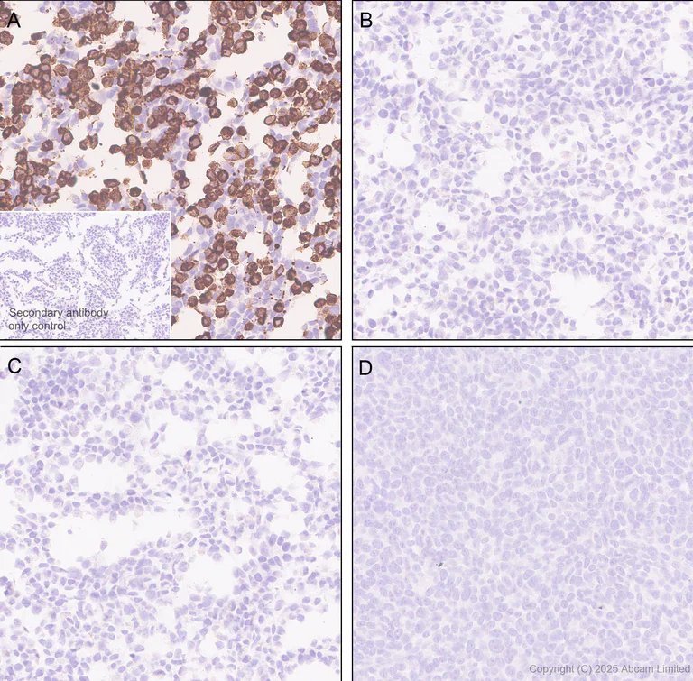 Immunohistochemistry (Formalin/PFA-fixed paraffin-embedded sections) - Anti-SV2C antibody [EPR30548-547] - BSA and Azide free (AB324234)