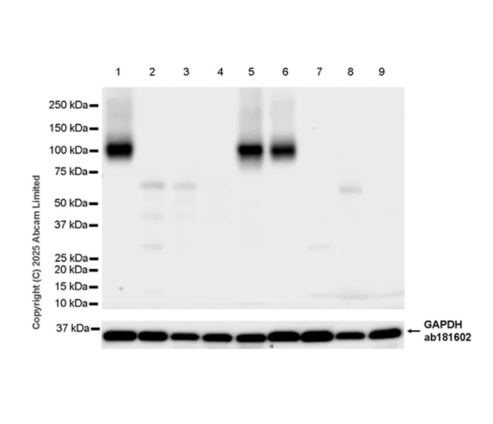 Western blot - Anti-SV2C antibody [EPR30548-547] - BSA and Azide free (AB324234)