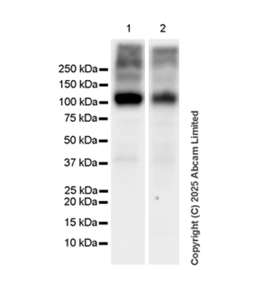Western blot - Anti-SV2C antibody [EPR30548-547] - BSA and Azide free (AB324234)