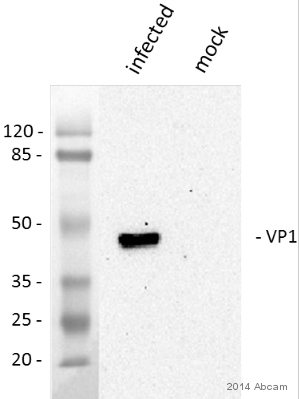 Western blot - Anti-SV40 VP1 antibody (AB53977)