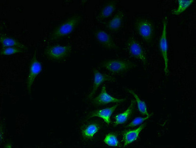 Immunocytochemistry/ Immunofluorescence - Anti-SVCT1 antibody (AB236878)
