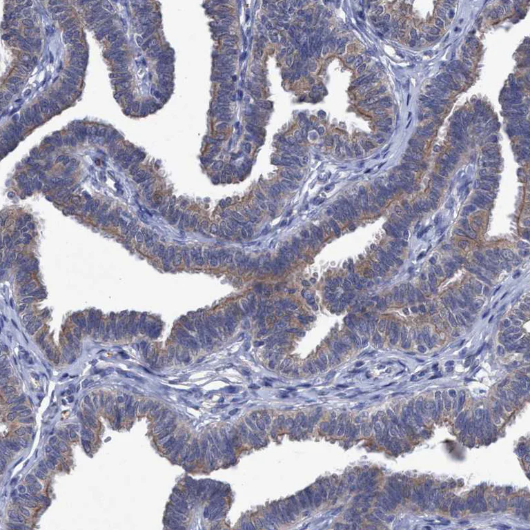 Immunohistochemistry (Formalin/PFA-fixed paraffin-embedded sections) - Anti-SVEP1 antibody (AB121677)