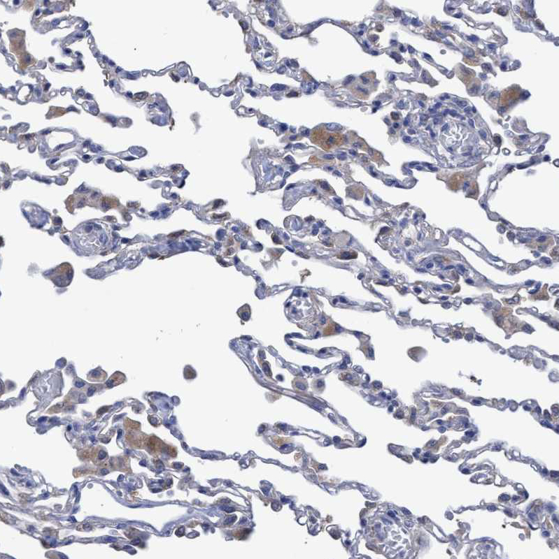 Immunohistochemistry (Formalin/PFA-fixed paraffin-embedded sections) - Anti-SVEP1 antibody (AB121677)