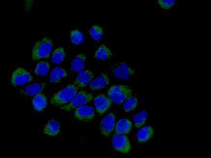 Immunocytochemistry/ Immunofluorescence - Anti-SVH antibody [EPR13763] - BSA and Azide free (AB250967), expandable thumbnail