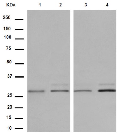 Western blot - Anti-SVH antibody [EPR13763] - BSA and Azide free (AB250967), expandable thumbnail