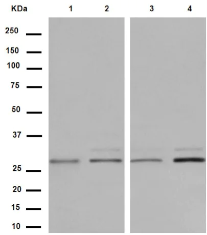 Western blot - Anti-SVH antibody [EPR13763] - C-terminal (AB188573)