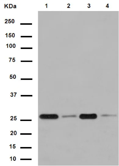 Western blot - Anti-SVH antibody [EPR13763] - C-terminal (AB188573)