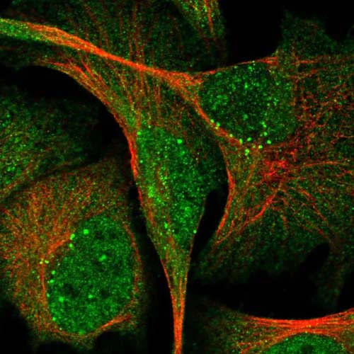 Immunocytochemistry/ Immunofluorescence - Anti-SVIP antibody (AB122590)