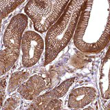 Immunohistochemistry (Formalin/PFA-fixed paraffin-embedded sections) - Anti-SVIP antibody (AB122590)