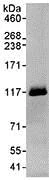 Immunoprecipitation - Anti-SWAN antibody (AB72319)