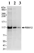 Western blot - Anti-SWAN antibody (AB72319)