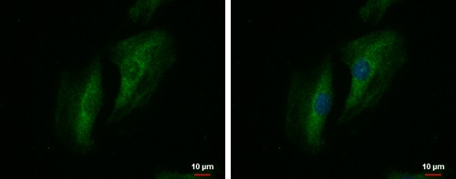 Immunocytochemistry/ Immunofluorescence - Anti-SWAP70 antibody - C-terminal (AB228846), expandable thumbnail