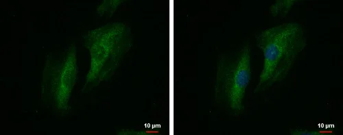 Immunocytochemistry/ Immunofluorescence - Anti-SWAP70 antibody - C-terminal (AB228846)