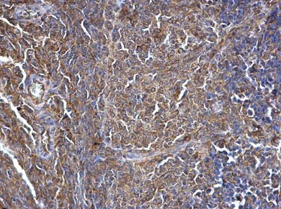 Immunohistochemistry (Formalin/PFA-fixed paraffin-embedded sections) - Anti-SWAP70 antibody - C-terminal (AB228846)