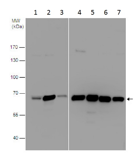 Western blot - Anti-SWAP70 antibody - C-terminal (AB228846), expandable thumbnail