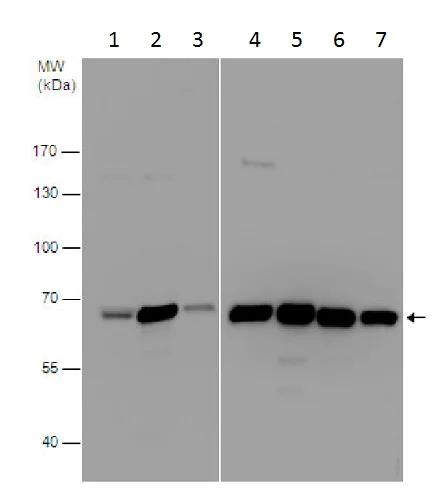 Western blot - Anti-SWAP70 antibody - C-terminal (AB228846)