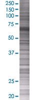 SWAP70 overexpression 293T lysate (whole cell)