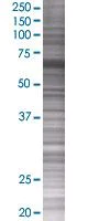 SDS-PAGE - SWAP70 overexpression 293T lysate (whole cell) (AB94234)