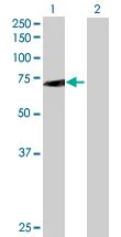 Western blot - SWAP70 overexpression 293T lysate (whole cell) (AB94234)
