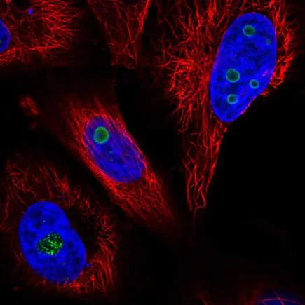 Immunocytochemistry/ Immunofluorescence - Anti-Swd2 antibody (AB220240)