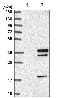 Western blot - Anti-Swd2 antibody (AB220240)