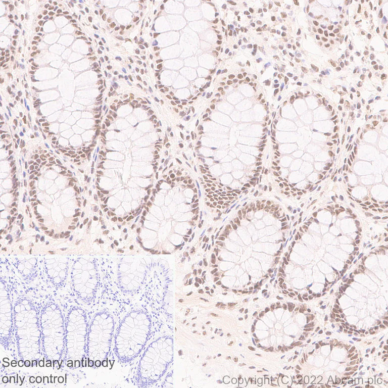 Immunohistochemistry (Formalin/PFA-fixed paraffin-embedded sections) - Anti-Swd2 antibody [EPR27034-63] (AB307554)