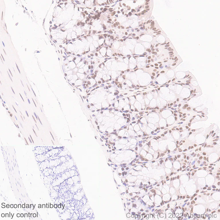 Immunohistochemistry (Formalin/PFA-fixed paraffin-embedded sections) - Anti-Swd2 antibody [EPR27034-63] (AB307554)