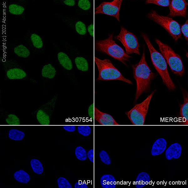 Immunocytochemistry/ Immunofluorescence - Anti-Swd2 antibody [EPR27034-63] - BSA and Azide free (AB307555)